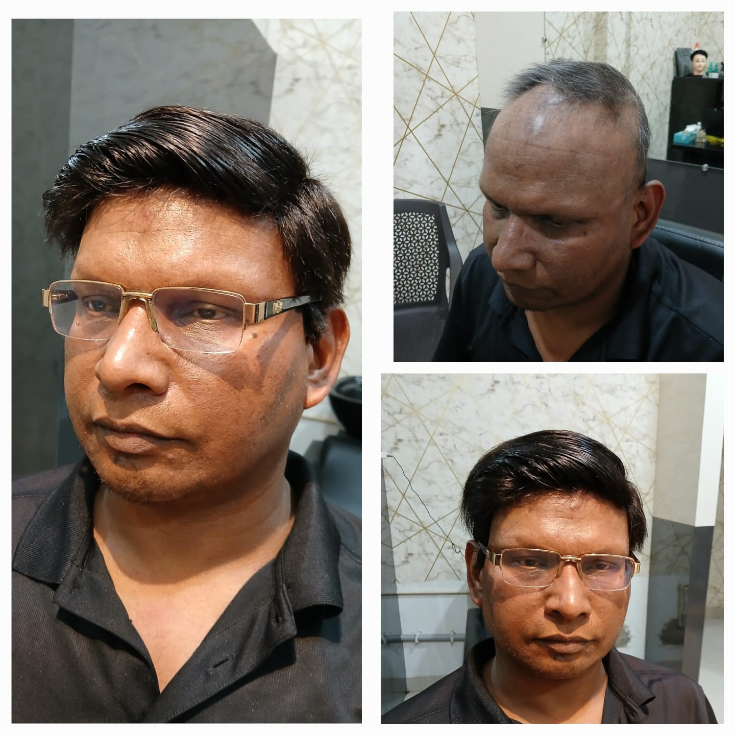 Transformation Case 1