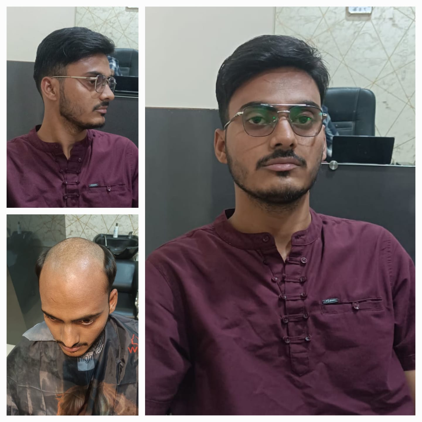 Transformation Case 3